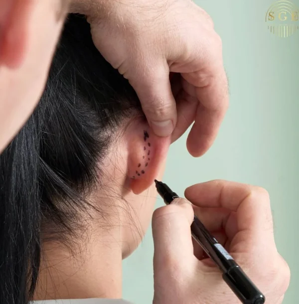 Kulak Estetiği (Otoplasti) Nedir