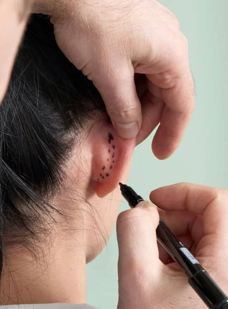 Kulak Estetiği (Otoplasti) Nedir