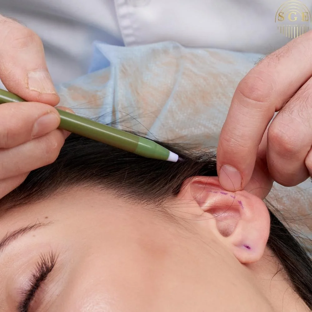 What is Ear Aesthetics (Otoplasty)