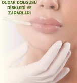 Dudak Dolgusu Risklerİ ve Zararları