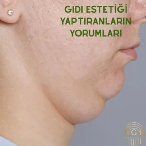 Gıdı estetiği