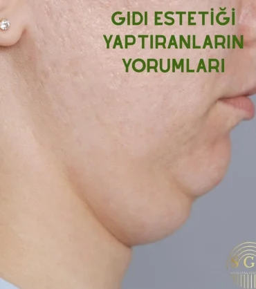 Gıdı estetiği